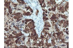 Image no. 1 for anti-Cellular Retinoic Acid Binding Protein 2 (CRABP2) antibody (ABIN1497620) (CRABP2 抗体)