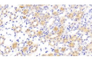 Detection of FUR in Mouse Kidney Tissue using Polyclonal Antibody to Furin (FUR) (FURIN 抗体  (AA 578-734))