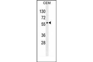 Western blot analysis of LIPC / Hepatic lipase Antibody (N-term) in CEM cell line lysates (35ug/lane). (LIPC 抗体  (N-Term))