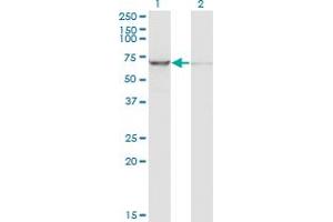 Western Blot analysis of IGF2BP2 expression in transfected 293T cell line by IGF2BP2 monoclonal antibody (M01), clone 4C6.