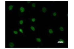 Immunostaining analysis in HeLa cells. (DHX38 抗体)