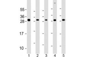 Western blot testing of human 1) SK-BR-3, 2) HeLa, 3) HCT116, 4) MCF-7 and 5) HL-60 cell lysate with NAA10 antibody at 1:2000. (NAA10 抗体  (AA 135-167))