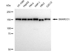 Western blotting analysis using SMARCC1 antibody (ABIN7800479).