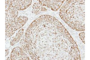 IHC-P Image Immunohistochemical analysis of paraffin-embedded Cal27 xenograft, using VDAC1, antibody at 1:500 dilution. (VDAC1 抗体)