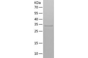 ACTR8 Protein (AA 1-329) (His tag)