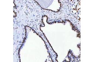 IHC analysis of DDX1 using anti-DDX1 antibody (ABIN7602050). (DDX1 抗体  (AA 562-740))