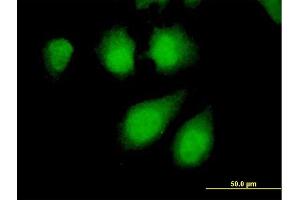 Immunofluorescence of purified MaxPab antibody to PPP2R4 on HeLa cell.