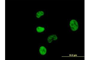 Immunofluorescence of purified MaxPab antibody to NCBP1 on HeLa cell. (NCBP1 抗体  (AA 1-790))