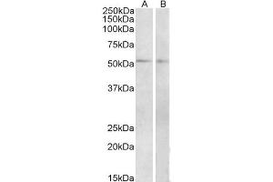Western Blot (2μg/ml) staining of Mouse (A) and Rat (B) Small Intestine lysate (35μg protein in RIPA buffer). (VIPR1 抗体  (Internal Region))