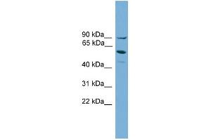 WB Suggested Anti-ALOX15B Antibody Titration:  0. (ALOX15B 抗体  (Middle Region))