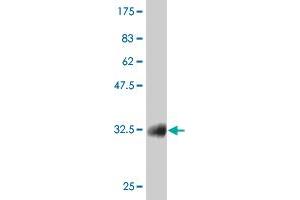 Western Blot detection against Immunogen (36. (CTNNB1 抗体  (AA 682-781))