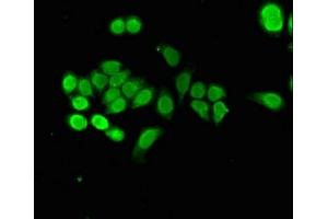 Immunofluorescent analysis of PC-3 cells using ABIN7161848 at dilution of 1:100 and Alexa Fluor 488-congugated AffiniPure Goat Anti-Rabbit IgG(H+L) (NUPR1 抗体  (AA 2-64))