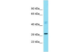 Host: Rabbit Target Name: RND3 Sample Type: NCI-H226 Whole Cell lysates Antibody Dilution: 1. (RND3 抗体  (C-Term))