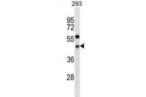 Western Blotting (WB) image for anti-Cyclin G2 (CCNG2) antibody (ABIN2998927) (Cyclin G2 抗体)