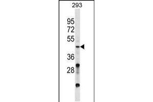 Western blot analysis in 293 cell line lysates (35ug/lane). (VSX2 抗体  (C-Term))