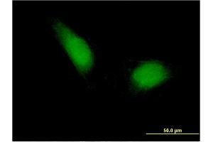 Immunofluorescence of monoclonal antibody to ETS1 on HeLa cell. (ETS1 抗体  (AA 173-272))