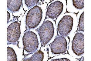 IHC analysis of AHA1/AHSA1 using anti-AHA1/AHSA1 antibody (ABIN7600708).