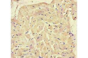Immunohistochemistry of paraffin-embedded human heart tissue using ABIN7168871 at dilution of 1:100 (SQSTM1 抗体  (AA 16-310))