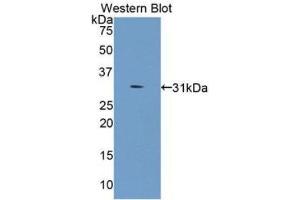 Western Blotting (WB) image for anti-Collagen, Type IV, alpha 5 (COL4A5) (AA 1461-1685) antibody (ABIN3201692) (COL4a5 抗体  (AA 1461-1685))