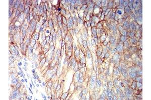 Immunohistochemistry (IHC) image for anti-Activated Leukocyte Cell Adhesion Molecule (ALCAM) (AA 227-381) antibody (ABIN5611126)