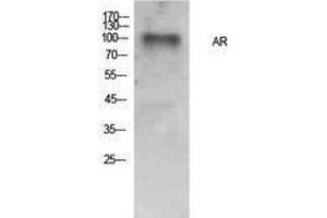 Western Blotting (WB) image for anti-Androgen Receptor (AR) (Internal Region) antibody (ABIN3181394) (Androgen Receptor 抗体  (Internal Region))