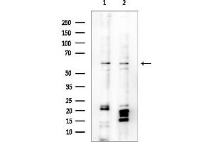 Western blot analysis of lysates from various samples, using TIG Antibody at 1/1000 dilution.