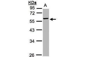 WB Image Sample(30 ug whole cell lysate) A:Hep G2 , 10% SDS PAGE antibody diluted at 1:1000 (MMP3 抗体)