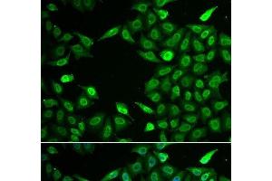 Immunofluorescence analysis of A549 cells using INTS6 Polyclonal Antibody (INTS6 抗体)