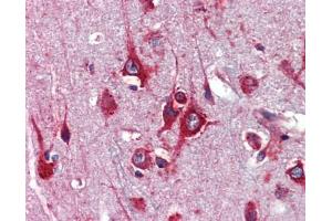 Immunohistochemistry (IHC) image for anti-Transcription Factor AP-2 gamma (Activating Enhancer Binding Protein 2 Gamma) (TFAP2C) (Middle Region) antibody (ABIN2777941)