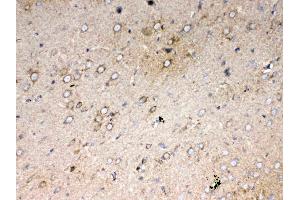 IHC analysis of Cytochrome C using anti-Cytochrome C antibody .