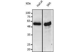 Anti-PS3 Ab at 1/2,500 dilution: lysates at 50 µg of total protein per Iane, rabbit polyclonal to goat lgG (HRP) at 1/10,000 dilution, (p53 抗体  (C-Term))