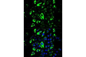 Immunofluorescence (IF) image for anti-Granzyme B (GZMB) antibody (ABIN1875446) (GZMB 抗体)