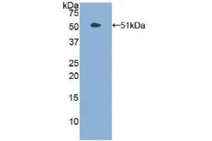 Detection of Recombinant PKM2, Human using Polyclonal Antibody to Pyruvate kinase isozymes M2 (PKM2) (PKM2 抗体  (AA 294-470))