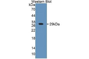 Western blot analysis of the recombinant protein. (ART4 抗体  (AA 51-275))