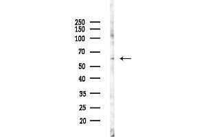 Western blot analysis of lysates from K562 cells(starvation 24h treatment), using RNPC3 Antibody at 1/1000 dilution.