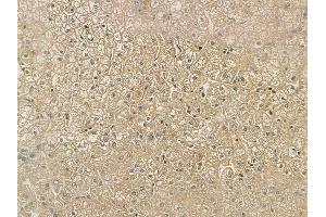 ABIN6257401 and ABIN6273968 at 1/100 staining human normal liver tissue by IHC-P.