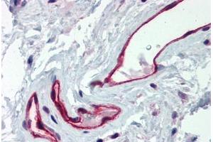 Human Colon, Vessels (formalin-fixed, paraffin-embedded) stained with DARC antibody ABIN337034 at 2. (DARC 抗体  (C-Term))