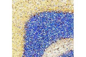 IHC analysis of SLC6A1 using anti-SLC6A1 antibody (ABIN5518957).