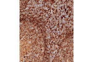 Immunohistochemical analysis of paraffin-embedded human tonsil tissue using (ABIN657755 and ABIN2846737) performed on the Leica® BOND RXm. (HLA-DPB1 抗体  (AA 77-105))