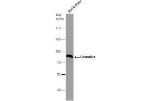 Western Blotting (WB) image for anti-Granulin (GRN) (Center) antibody (ABIN2854868)
