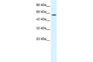 WB Suggested Anti-MEIS2 Antibody Titration:  1. (MEIS2 抗体  (N-Term))