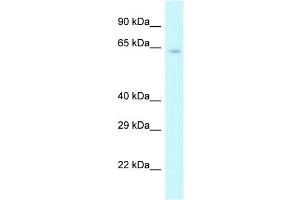 Western Blotting (WB) image for anti-Cleavage Stimulation Factor, 3' Pre-RNA, Subunit 2, 64kDa (CSTF2) (N-Term) antibody (ABIN2778765)