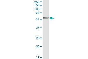 Immunoprecipitation of RNF25 transfected lysate using anti-RNF25 MaxPab rabbit polyclonal antibody and Protein A Magnetic Bead , and immunoblotted with RNF25 MaxPab mouse polyclonal antibody (B01) . (RNF25 抗体  (AA 1-459))