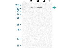 Western blot analysis of Lane 1: RT-4, Lane 2: U-251 MG, Lane 3: Human Plasma, Lane 4: Liver, Lane 5: Tonsil with SPOCD1 polyclonal antibody  at 1:250-1:500 dilution. (SPOCD1 抗体)