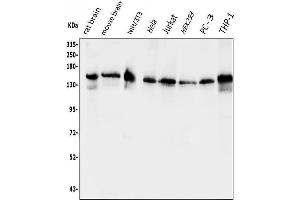 Western blot analysis of EPS15 using anti-EPS15 antibody (ABIN7599231).