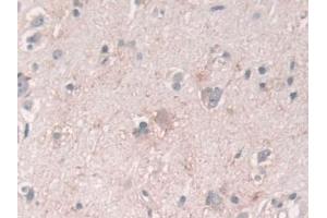 Immunohistochemistry (IHC) image for anti-USP6 N-terminal Like (USP6NL) (AA 1-292) antibody (ABIN7430093)