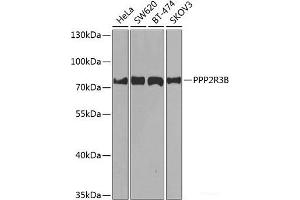 Western blot analysis of extracts of various cell lines using PPP2R3B Polyclonal Antibody at dilution of 1:1000. (PPP2R3B 抗体)