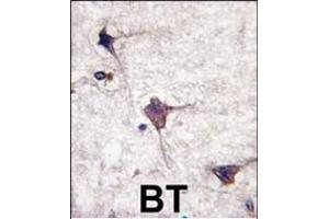 Immunohistochemistry (Paraffin-embedded Sections) (IHC (p)) image for anti-Protein tyrosine Phosphatase, Receptor Type, R (PTPRR) (AA 234-265), (N-Term) antibody (ABIN392828)