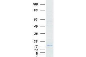 Western Blotting (WB) image for Protein Tyrosine Phosphatase Type IVA, Member 3 (PTP4A3) (Transcript Variant 2) protein (Myc-DYKDDDDK Tag) (ABIN2729656)