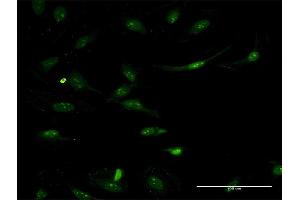 Immunofluorescence of monoclonal antibody to ASS1 on HeLa cell. (ASS1 抗体  (AA 121-220))